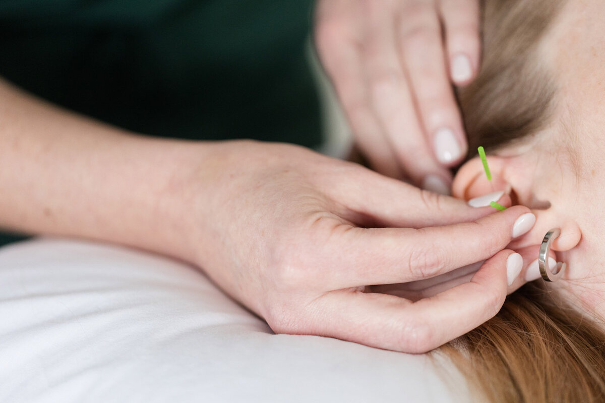 Eau Claire Acupuncture - 222