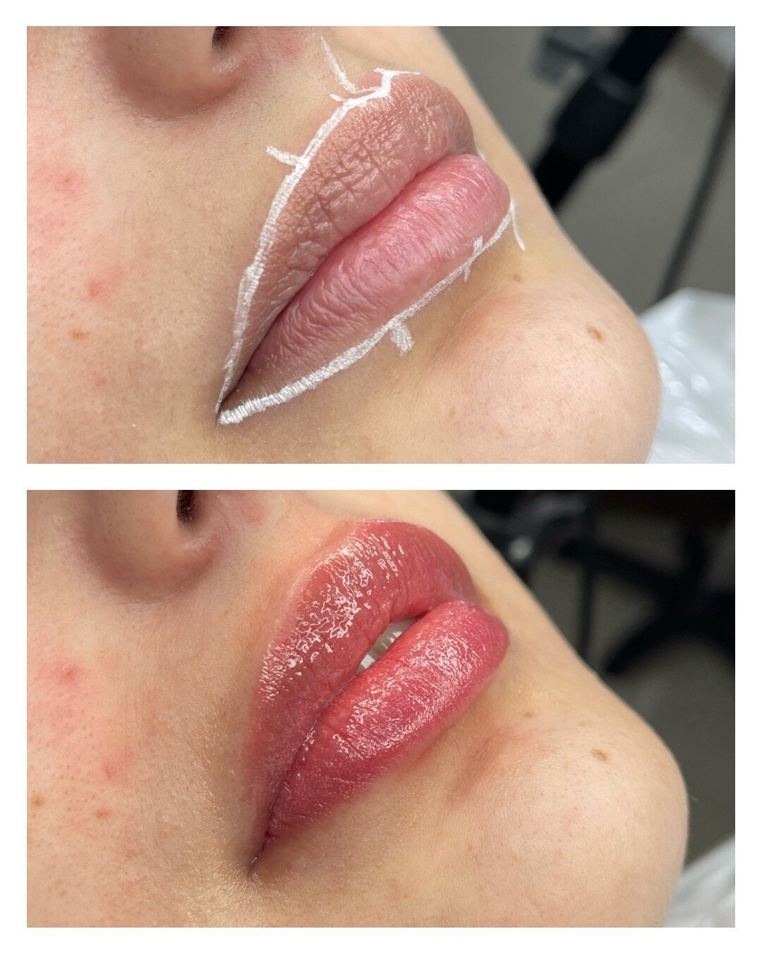 Lip Blush - BeforeAfter Dea
