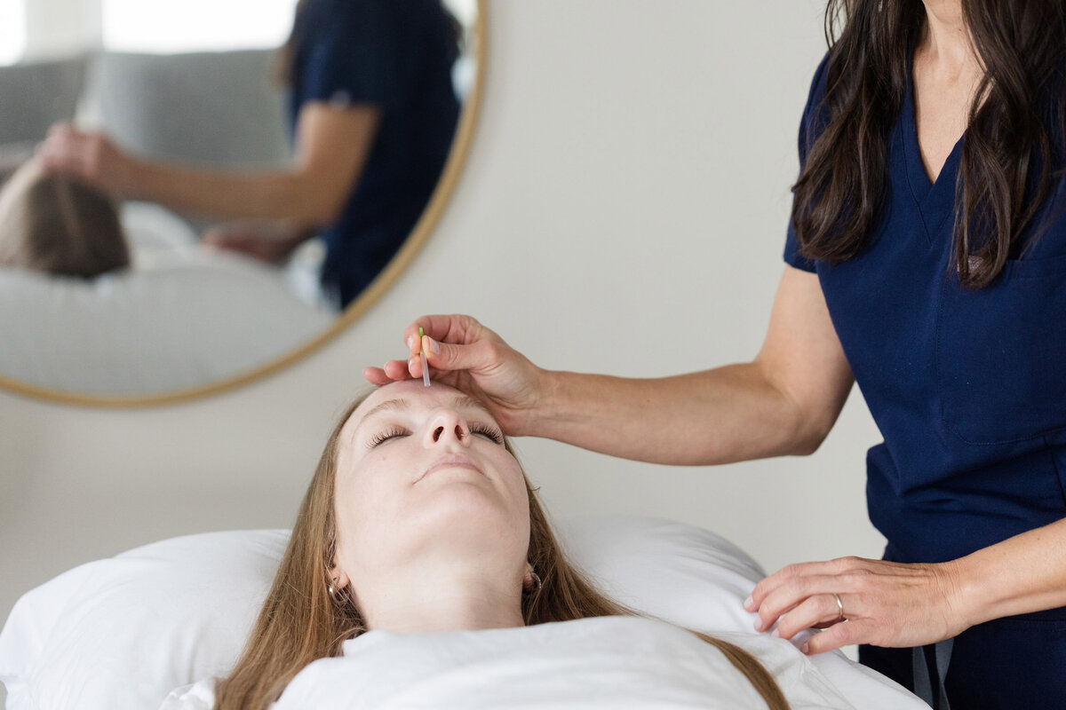 Woman laying on a table with an acupuncture needles in her forehead 