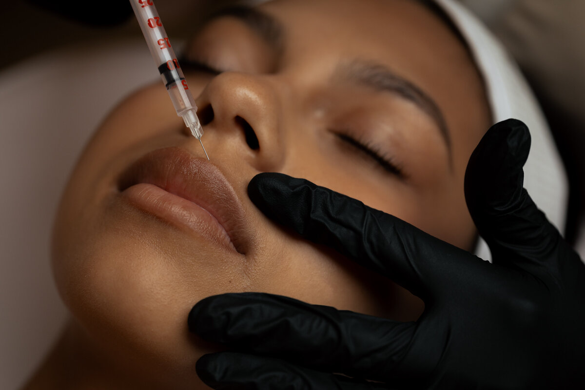 lip-filler
