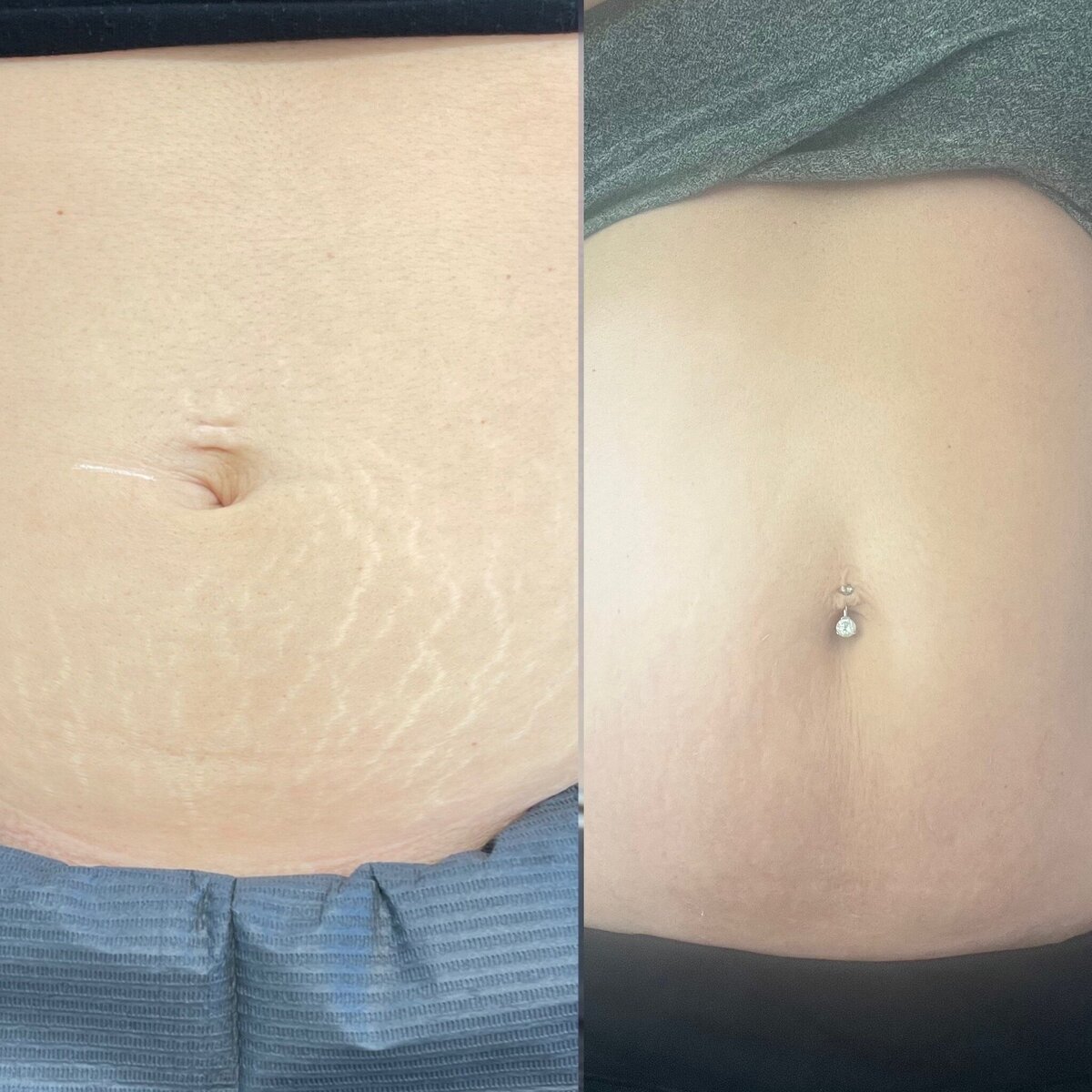 B2C5FA4C-A844-43E9-868F-F2DC65BBB97A