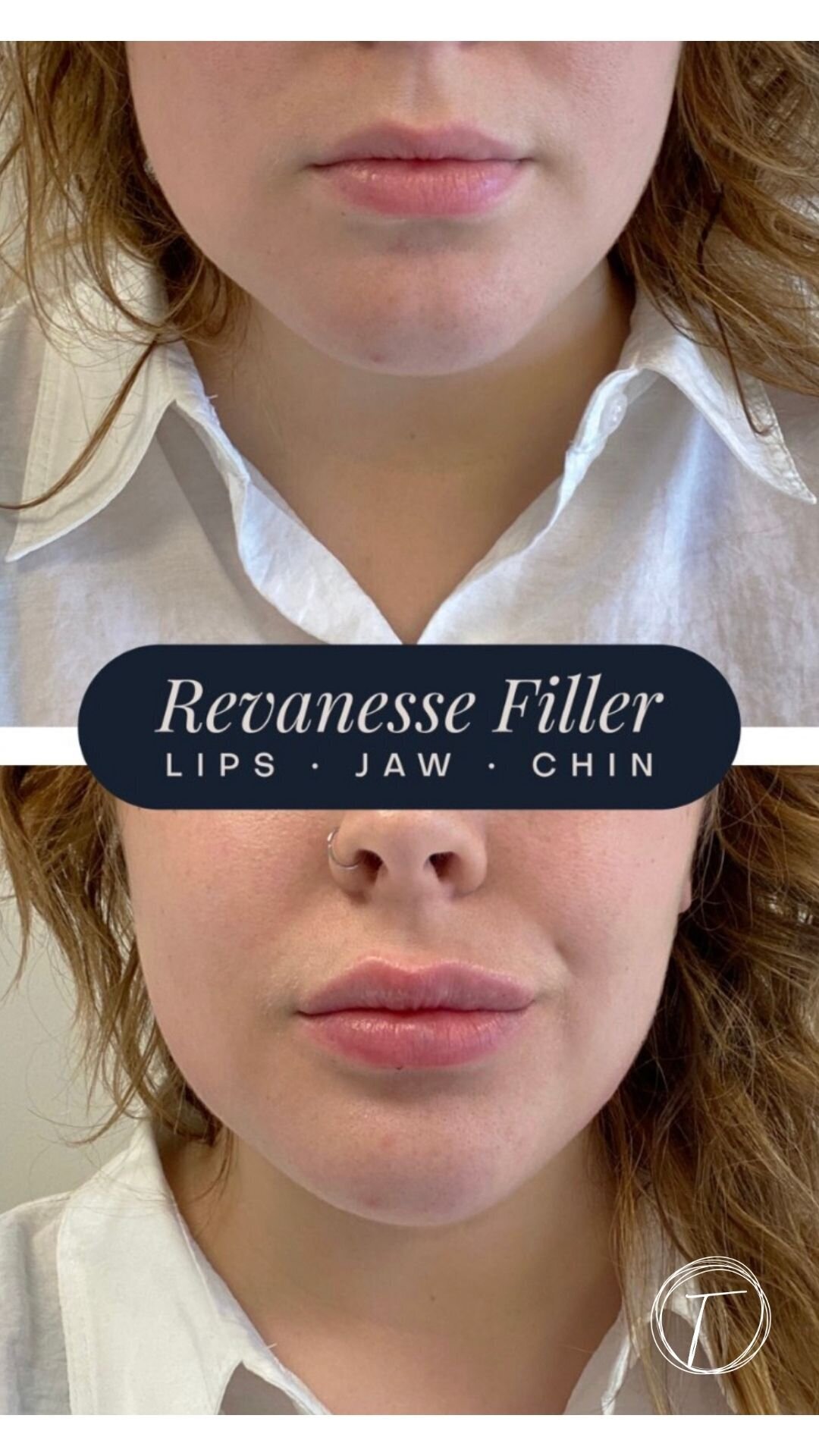 before:after results with look timeless - 16