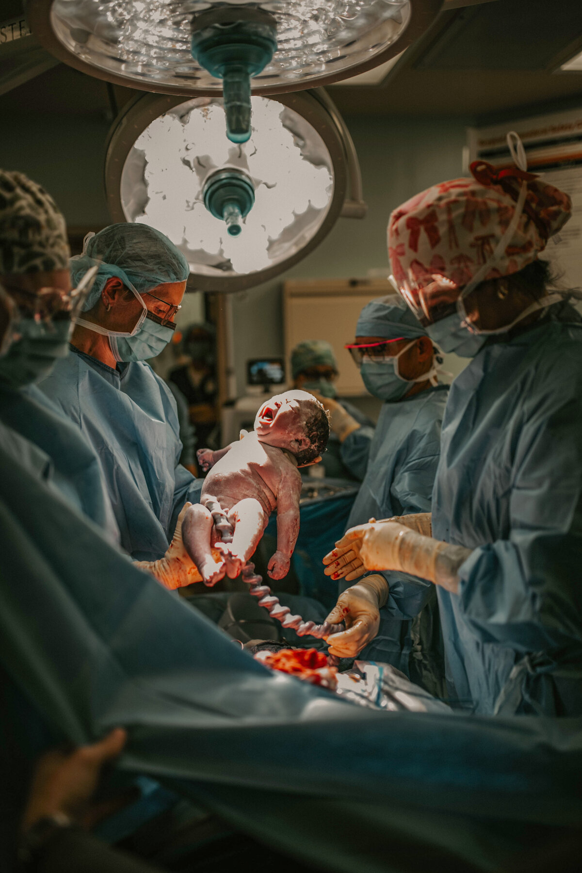 OCALA-CSECTION-PHOTOGRAPHER-DOULA (3)