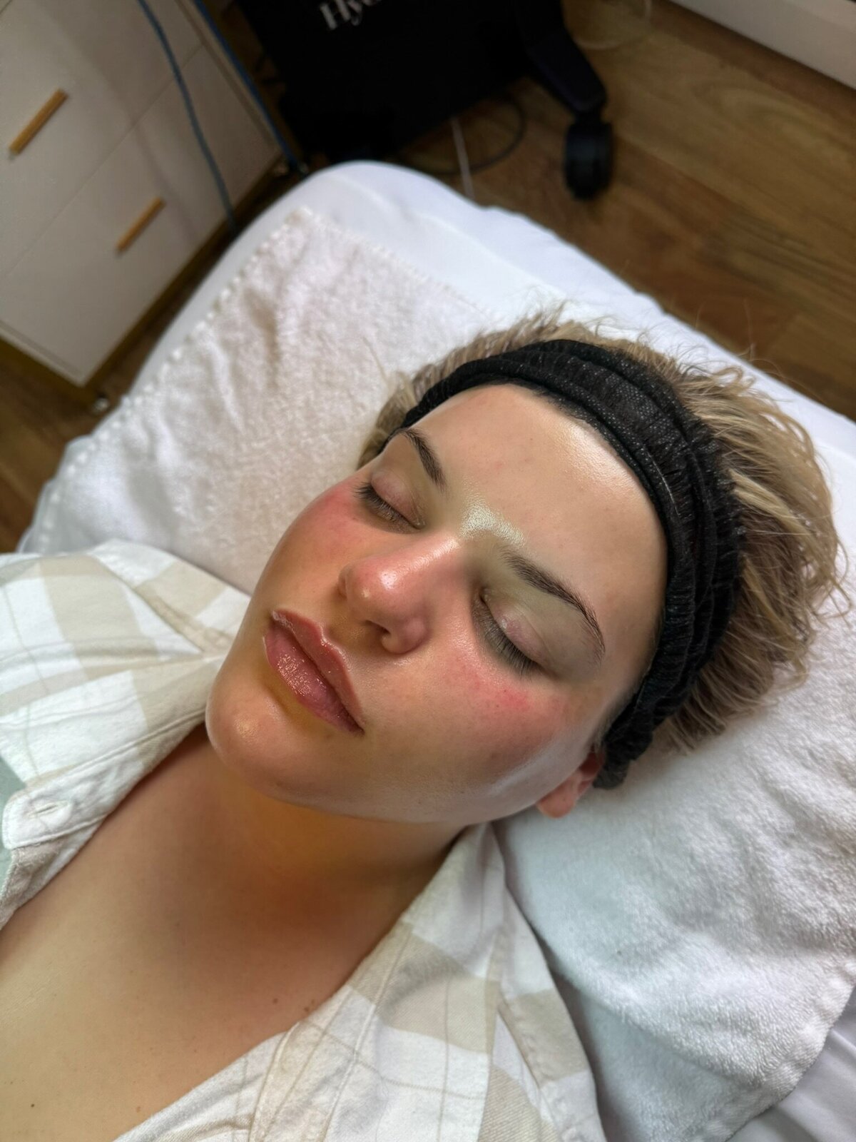 Fresh-Skin_Babes-Facial_Transformation3