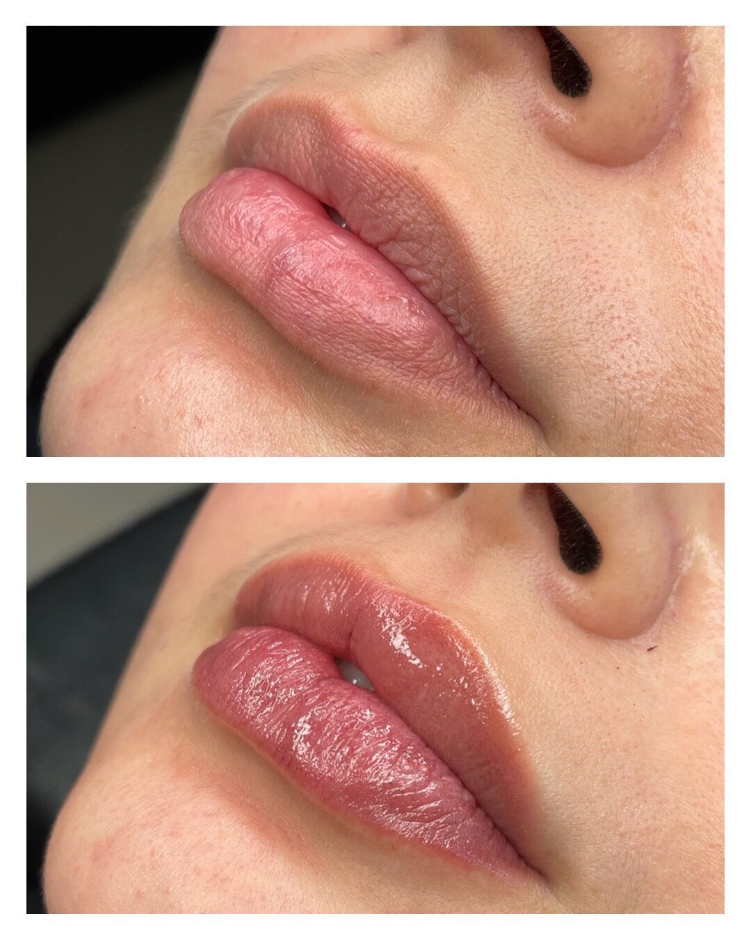 Lip Blush - BeforeAfter Nat