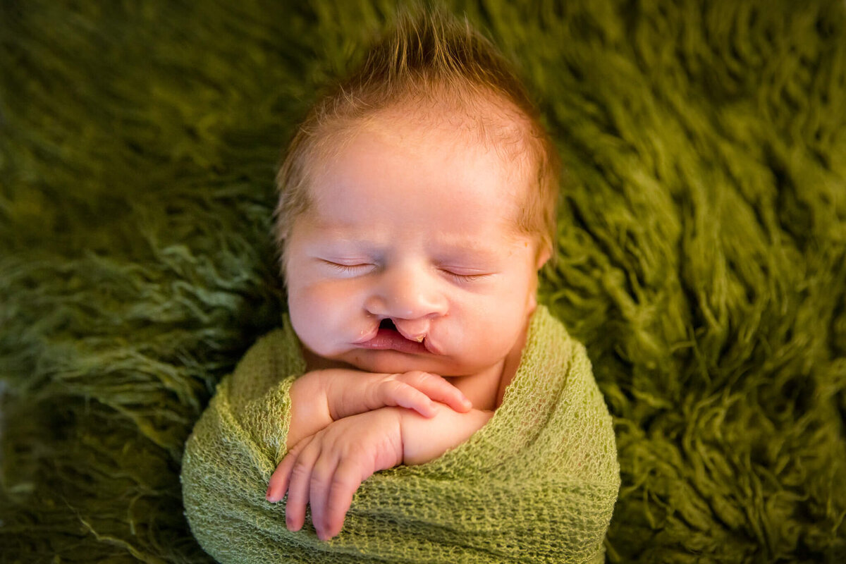 cincinnati-newborn-photo-baby-boy-sleeping-cleft-palate