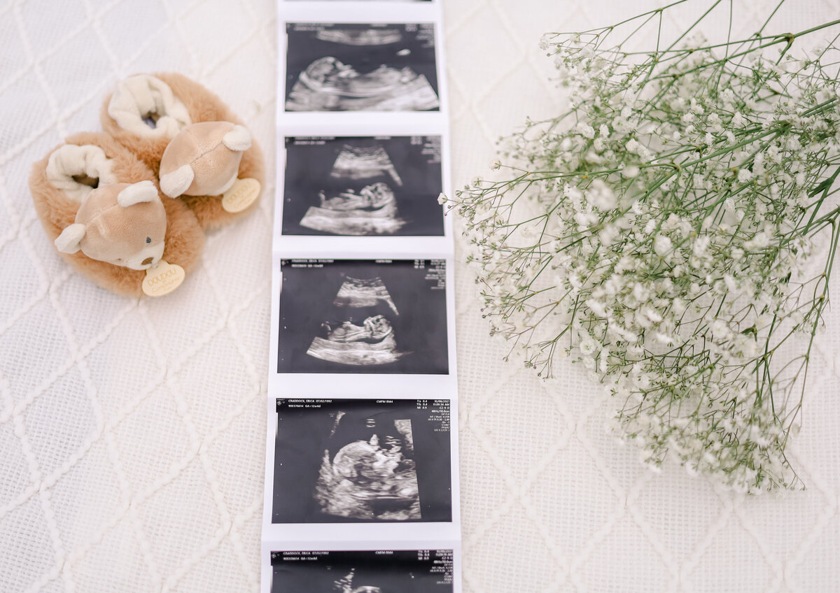 AEPHOTOGRAPHY+Baby Max-35