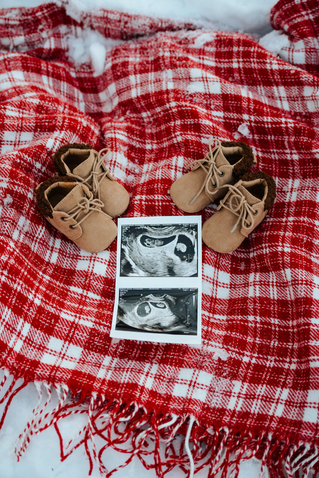ultrasound twins red blanket baby booties vermont winter pregnancy announcement