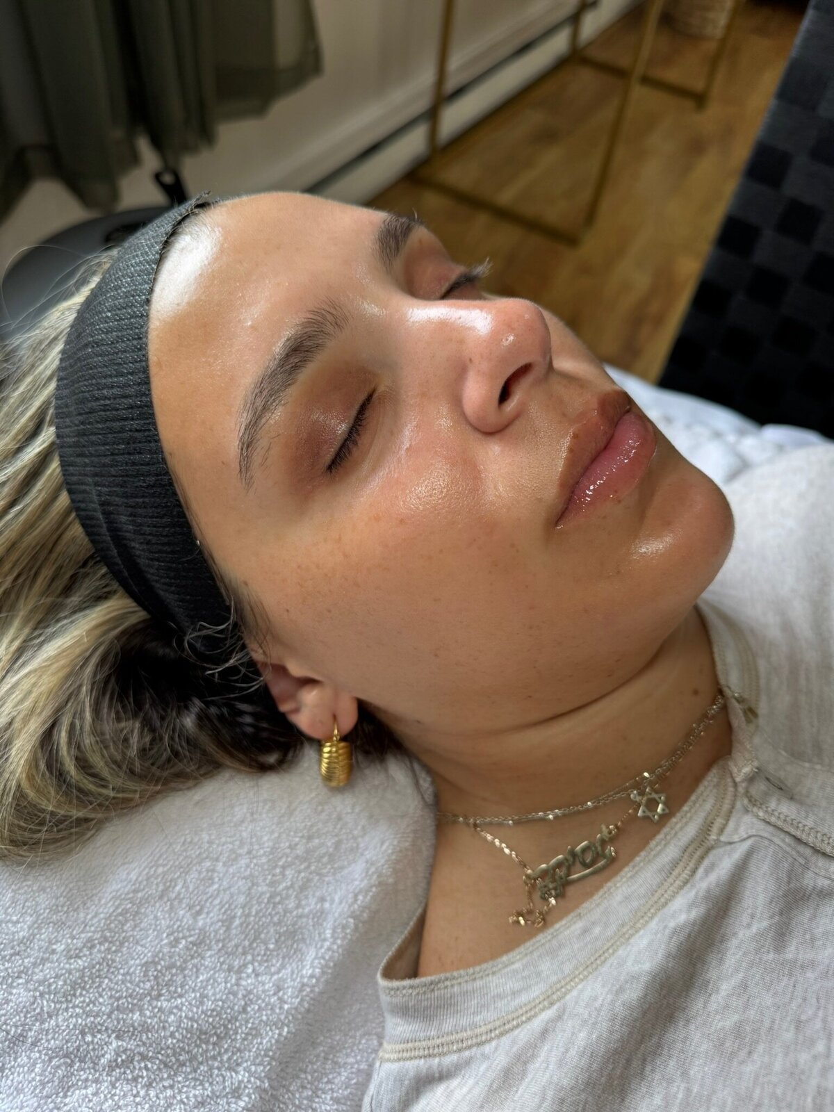 Fresh-Skin_Babes-Facial_Transformation4