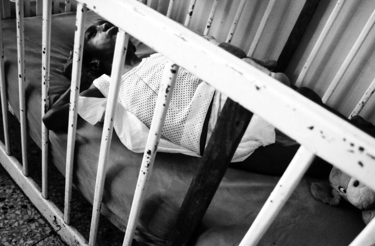 black and white image of child shot through crib bars showing a child with physical disability
