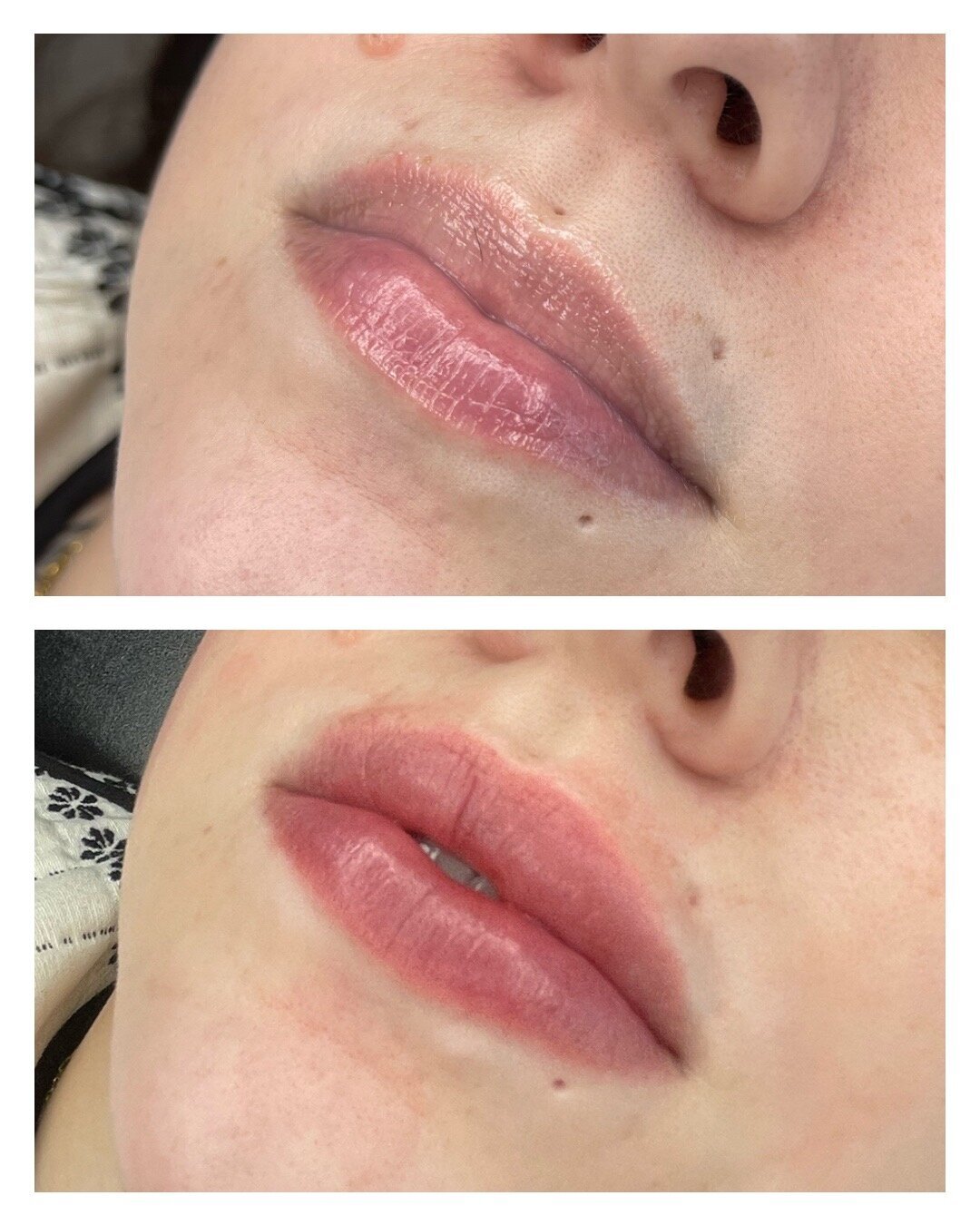 Lip Blush - BeforeAfter Helo