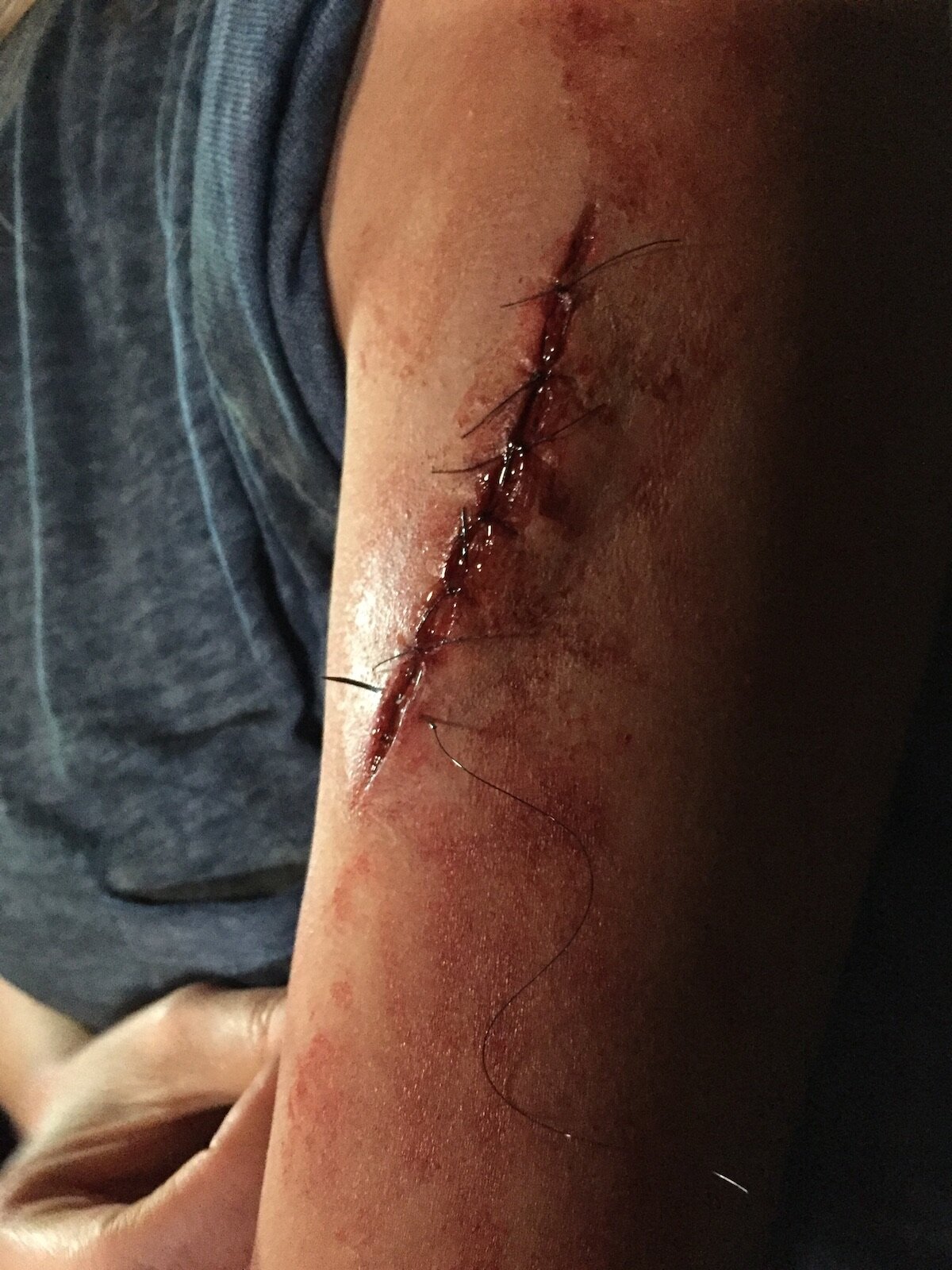 arm-with-fake-stitches-makeup-fx