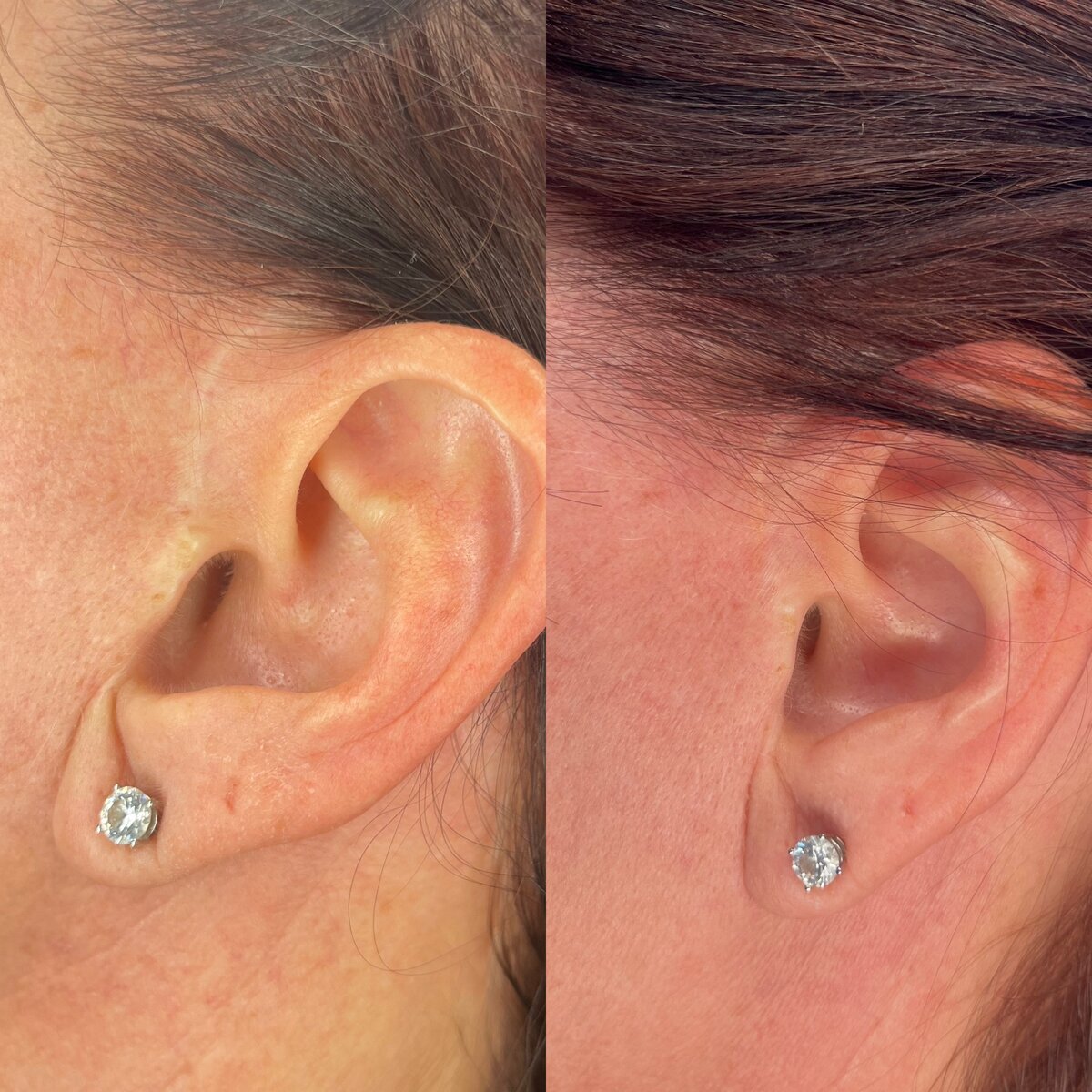 99130E81-7E06-46D2-A1C3-7ACCD087DFE4 (1)