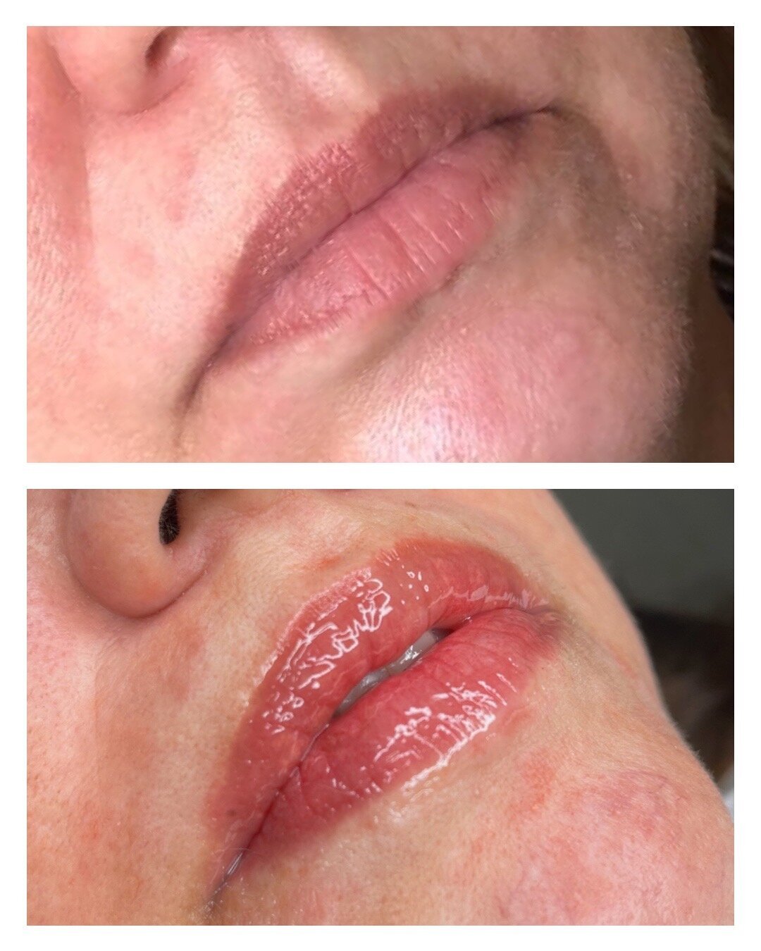 Lip Blush - BeforeAfter Surama