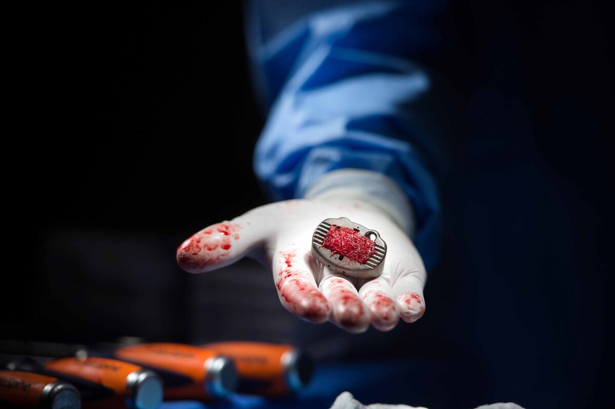 A seaspine surgical implant photographed for marketing on surgeon's hand
