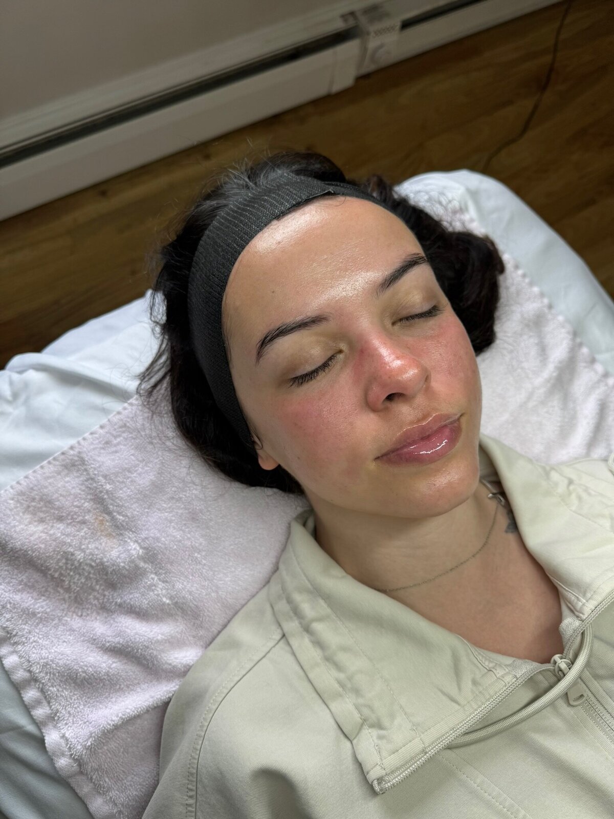 Fresh-Skin_Babes-Facial_Transformation6