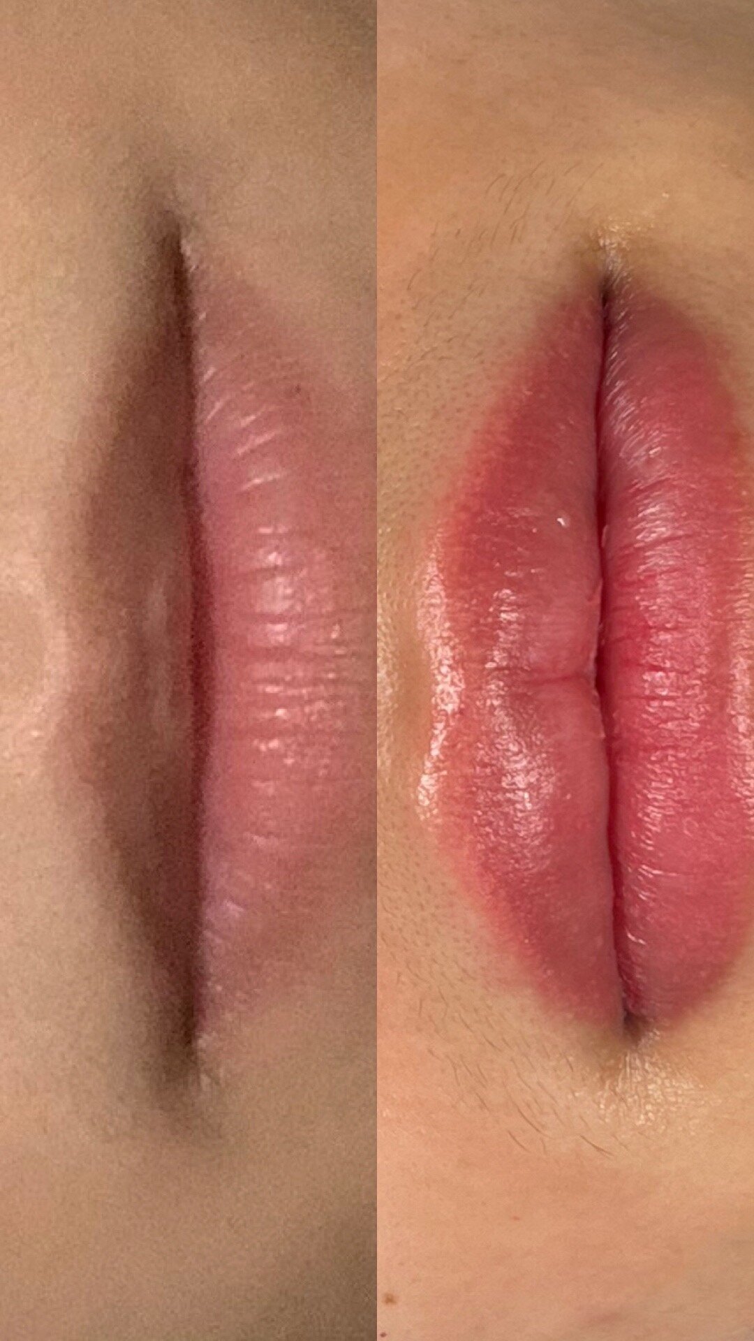 emily liblush beforeafter