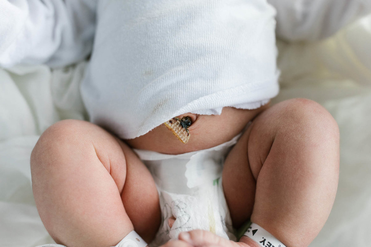 Laurie Baker photographs newborn umbilical cord and hospital bracelets on newborn
