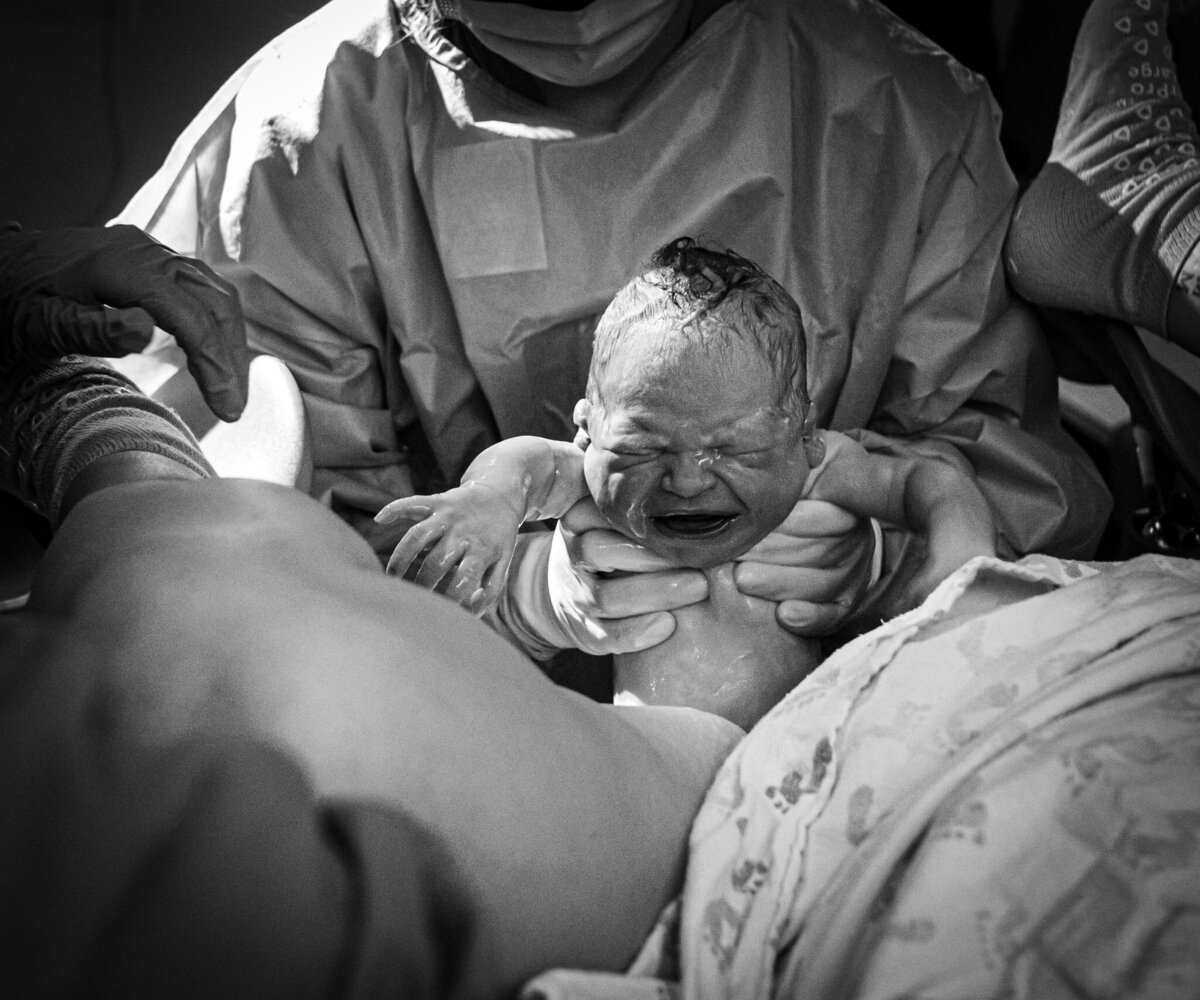 A black and white image of a freshly born baby being held by a doctor with both hands, and the doctor is pulling the baby up and about to set the baby on the mother's chest at Overlake Childbirth Center in Bellevue, WA.