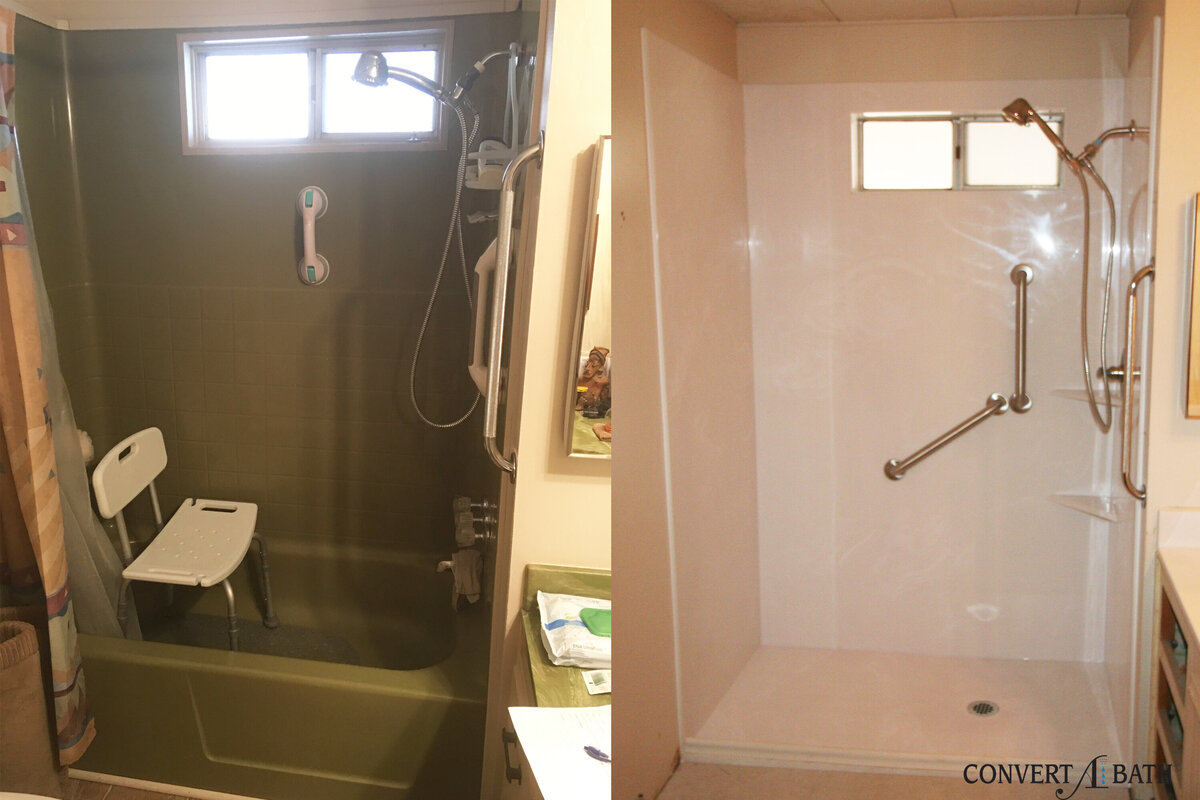 VA Before & After