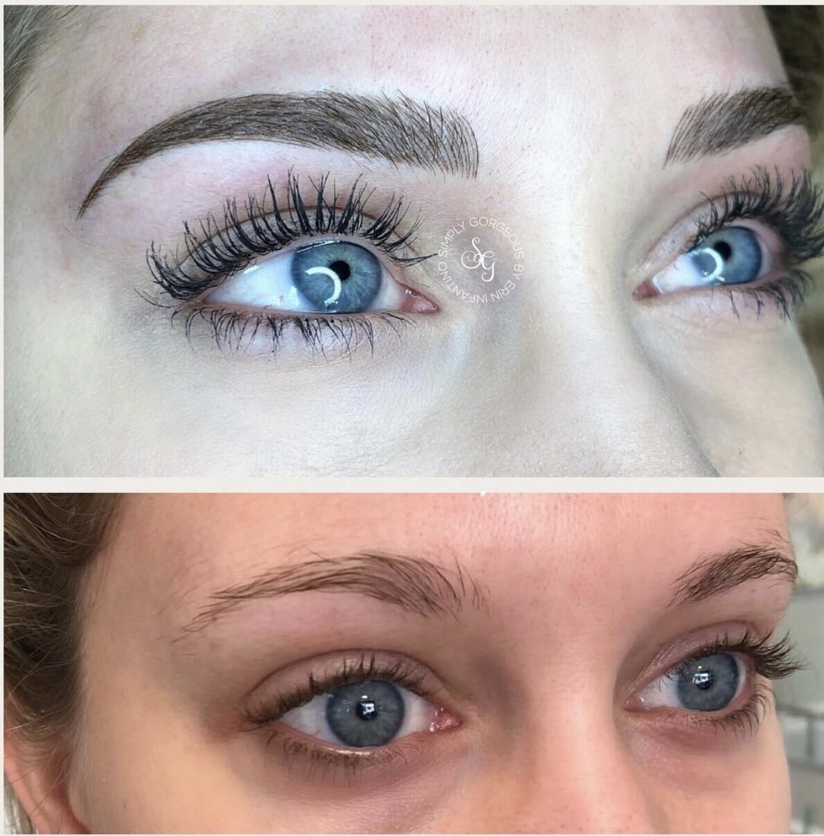 CT microblading results