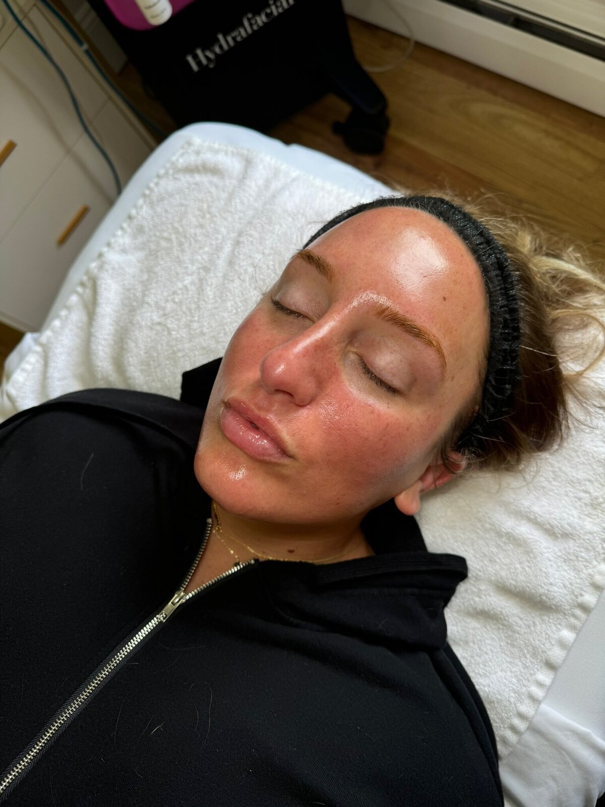 Fresh-Skin_Babes-Facial_Transformation2