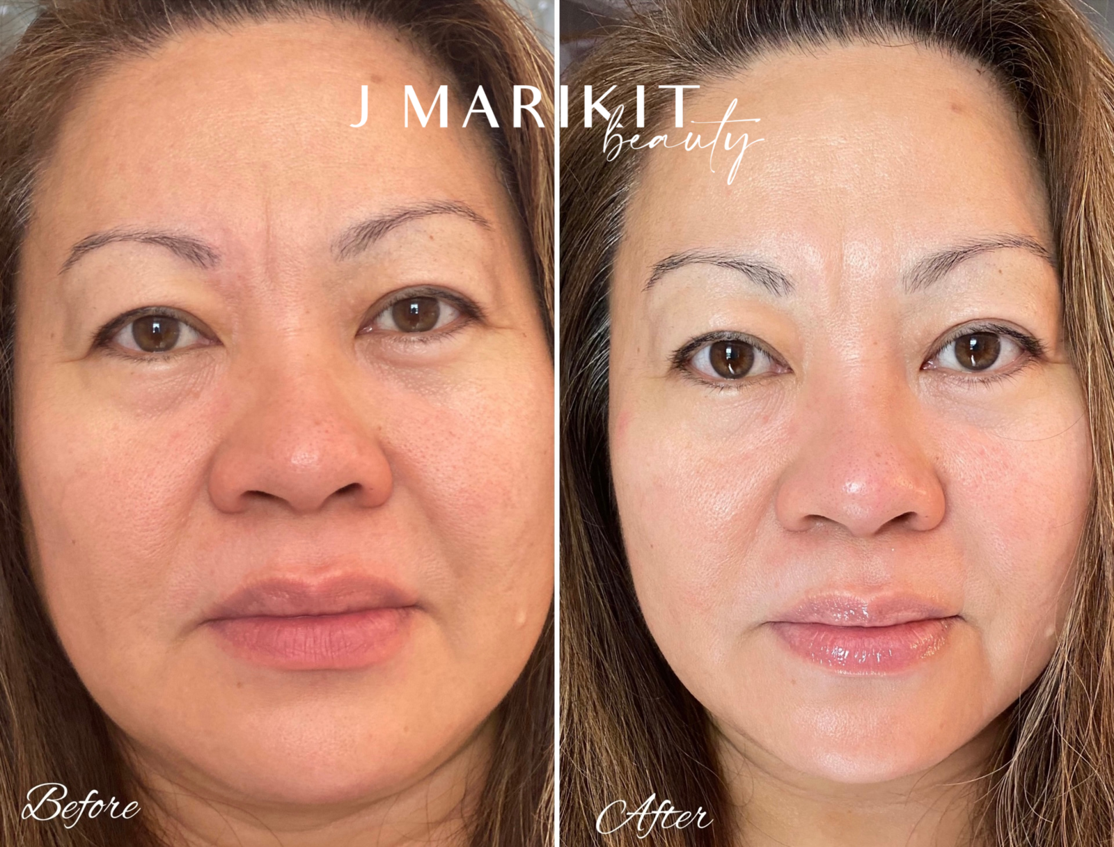 Beauty services such as micro-dermabrasion helped this client have radiant, smooth skin.