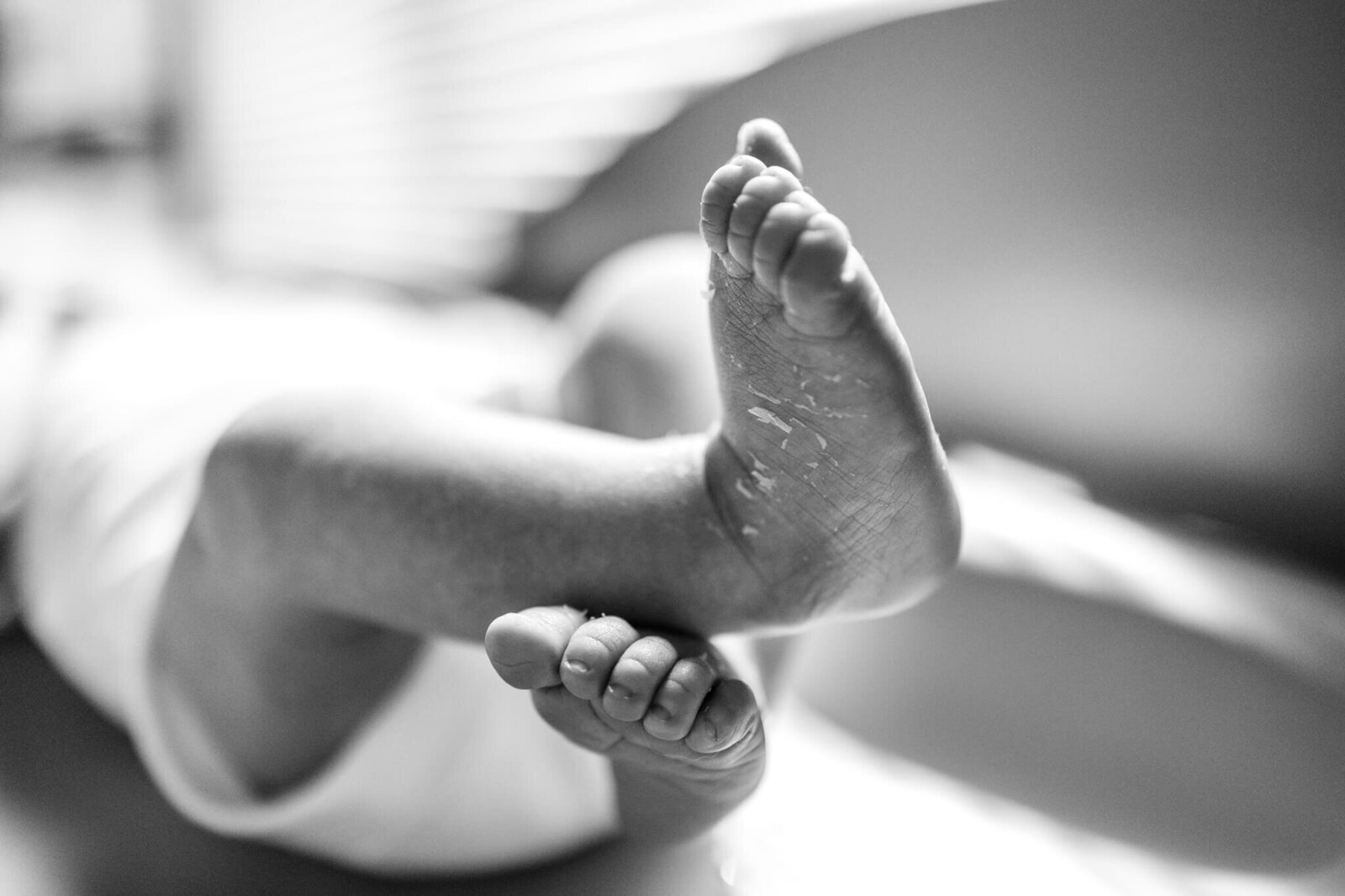 Baby feet with flaky newborn skin