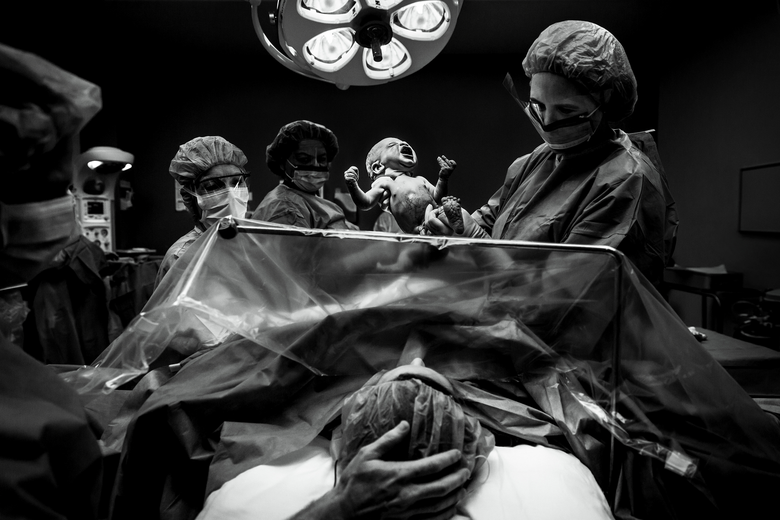birth photographer, columbus, ga, atlanta, c-section, cesarean, clear drape, doctor holding up baby, ker-fox photography_4476-Edit-2