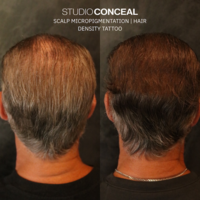 gilbert-hairloss-clinic