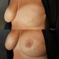 nipple-tattoo-2