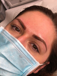 Before and after nano brow