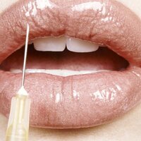 8 Things You Should Know Before Getting Injectables