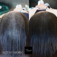 arizona-female-hairloss