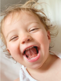 Pre-orthodontic treatment for children