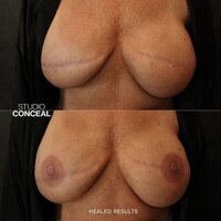 Nipple Tattoo Artist in Arizona