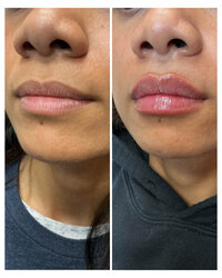 Injectables Page 10