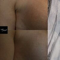 inkless-stretch-mark-revision