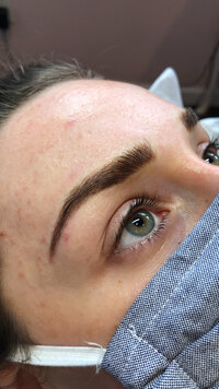 Before and after microblading 2