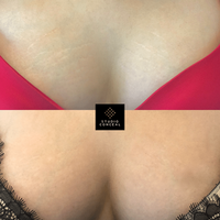 asset-49