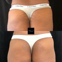 Dionne-Butt-2