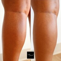 stretch-mark-tattoo-training-in-arizona