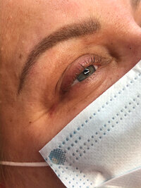 Before and after microblading