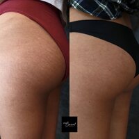 Angie-4-2