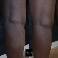 Black-skin-camouflage-2-2