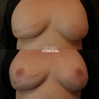 az_3d_areola tattoo_4
