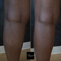 Black-skin-camouflage-3