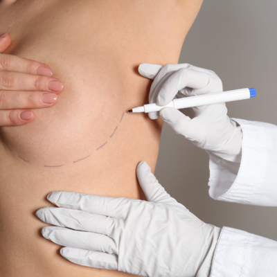 Image of woman holding hand over a chest area with incision marks