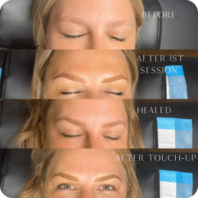 Eyebrow treatment journey and results