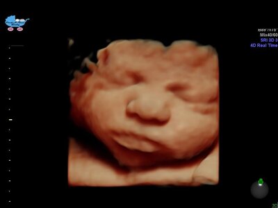 HD Ultrasound Image Gallery